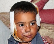 İSMAIL GÜMÜŞ - Köpeğin Isırdığı Çocuk Ölümden Döndü