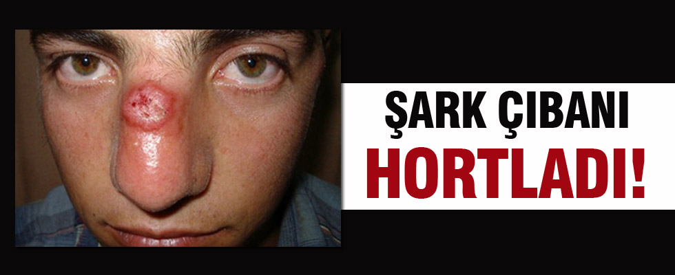 Şark Çıbanı Hortladı