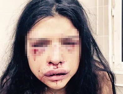 Onur Özbizerdik'in kız arkadaşı yaşadığı dehşeti anlattı