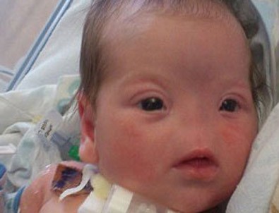 Dünyaya burunsuz geldi