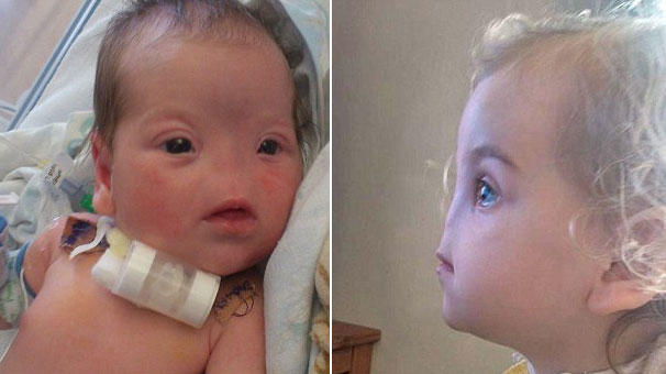 Dünyaya burunsuz geldi