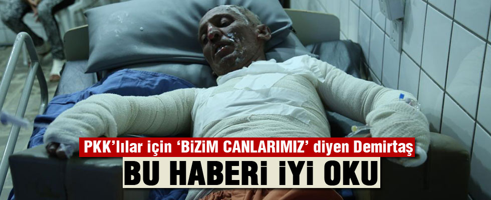 Oğlunu kaçıran PKK'yı protesto için kendini yaktı