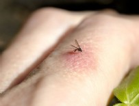 GENETİĞİ DEĞİŞTİRİLMİŞ SİVRİSİNEK - Sivrisinekler en çok kimleri ısırır?
