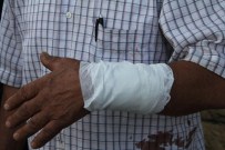 ÇAYKENT - Taş Ocağı Tesisine Karşı Çıkan Kişiye Saldırı İddiası