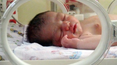 Beş Günlük Bebek, Hemodiyafiltrasyon Tedavisiyle Yeniden Hayata Tutundu