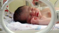 ÇOCUK HASTANESİ - Beş Günlük Bebek, Hemodiyafiltrasyon Tedavisiyle Yeniden Hayata Tutundu