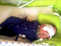 KAN UYUŞMAZLıĞı - Beyni Gözüne İnen Minik Muhammed Yardım Bekliyor