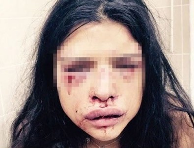 Melis Çakır ortaya çıktı