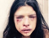 ONUR ÖZBİZERDİK - Melis Çakır ortaya çıktı