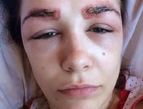 DAILY MAIL - Genç kız güzelleşmek isterken gözünden oluyordu