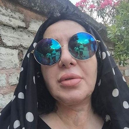 Nur Yerlitaş'tan gıdısını aldırdı