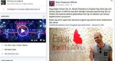 Elnur, Organik Saç Ekimi Sayesinde Beresini Çıkardı