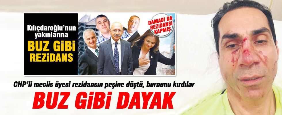 Buz gibi dayak