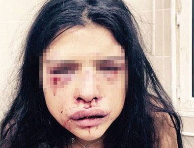 Onur Özbizerdik'in sevgilisi şikayetini geri çekti