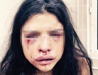 DÜNDAR KILIÇ - Onur Özbizerdik'in sevgilisi şikayetini geri çekti