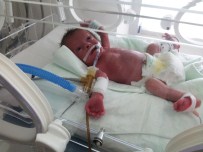 İKİZ BEBEKLER - 19 Günlük İkiz Bebekleri Ölüm Ayırdı