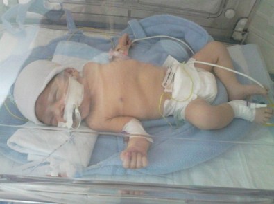 Minik Zehra Ameliyat Olamadan Öldü