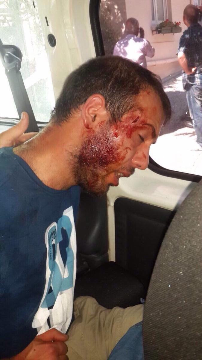 Dolmabahçe Sarayı'na bombalı saldırı