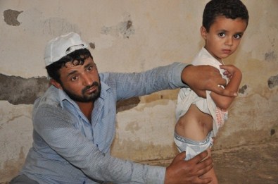 Suriye'de Vurulan Baba Oğul Türkiye'de Hayata Tutundu