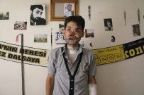 SERDAR NASIR - Yüzünde Tüfek Fişeği Patlayan Ahmet İlk Ameliyatını Oldu