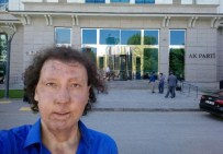 ENGELLİ ADAY - Yüz Nakli Yapılan Kişi Aday Adayı Oldu