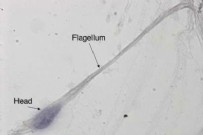 KISIRLIK TEDAVİSİ - Yapay sperm üretildi