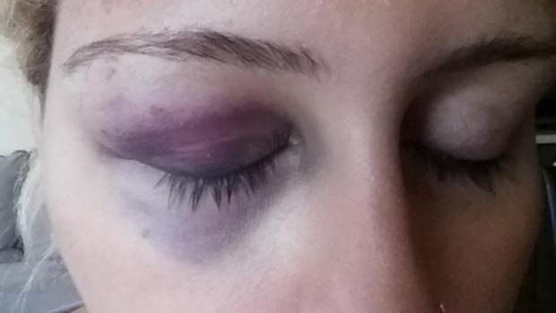 Kübra Yılmaz'ın çığlığı