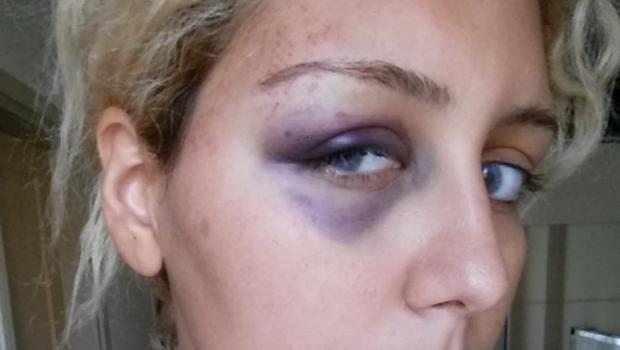 Kübra Yılmaz'ın çığlığı