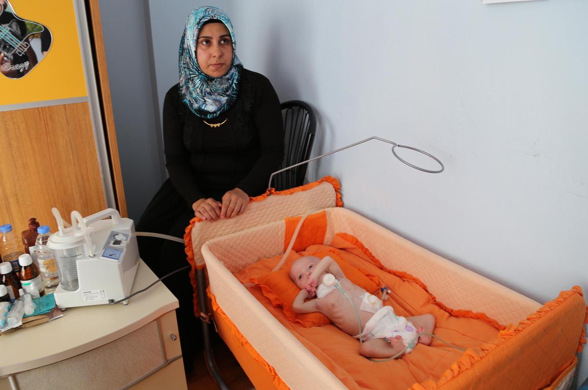 6 aylık bebek 6 kere ameliyat oldu