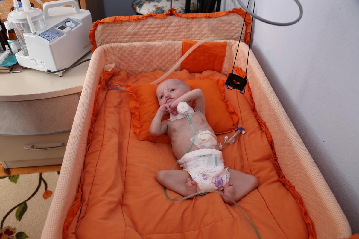 6 aylık bebek 6 kere ameliyat oldu