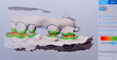 Estetik Dişte Dijital Devir