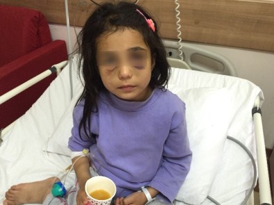 Üvey Annesinin Dövdüğü Kız Çocuğu Devlet Korumasına Alınıyor