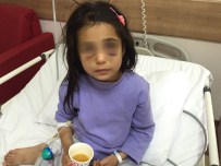 DAYAK - Üvey Annesinin Dövdüğü Kız Çocuğu Devlet Korumasına Alınıyor