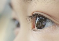 ORBITAL - Kaybedilen Göze Yüz Güldürücü Tedavi Açıklaması Göz Protezi