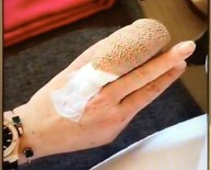 Hollywood yıldızının parmağı koptu!