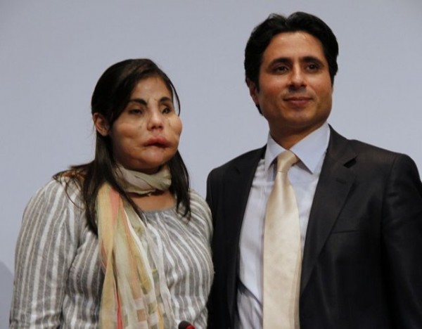 Türkiye'de yüz nakli olan Hatice Nergis hayatını kaybetti!