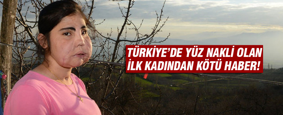 Türkiye'de yüz nakli olan Hatice Nergis hayatını kaybetti!