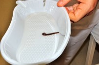 Yaşlı Kadının Burnundan Sülük Çıktı