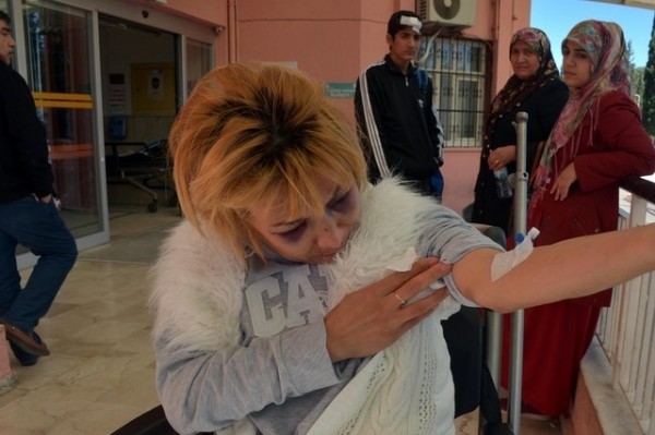 Bulaşığı makinede yıkadığı için eşini hastanelik etti