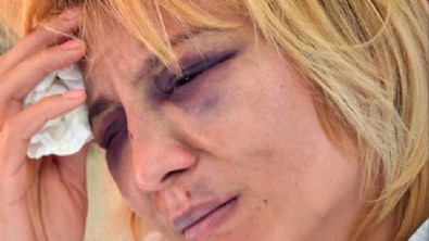 Bulaşığı makinede yıkadığı için eşini hastanelik etti