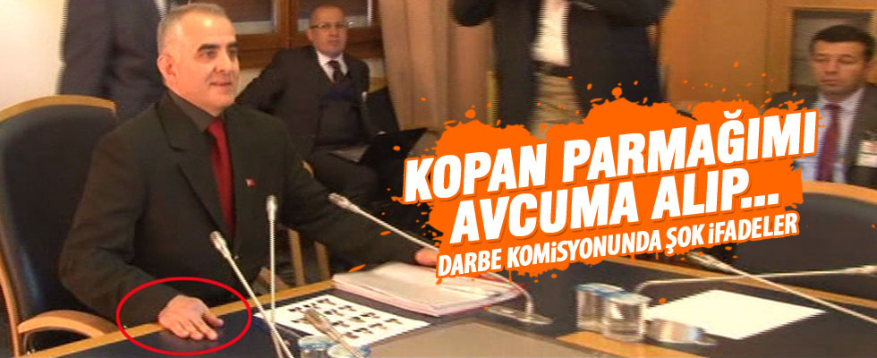 'Kopan parmağımı avucuma alıp öyle çatıştım'