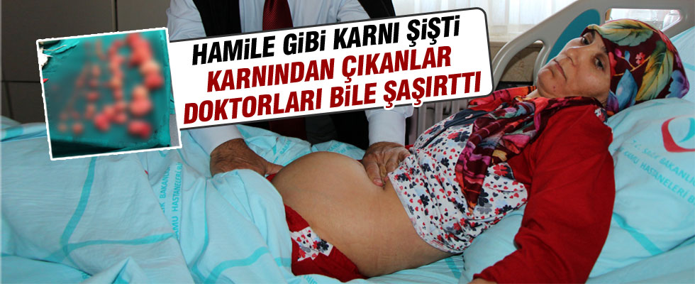 Şişen karnından çıkanlar şaşırttı