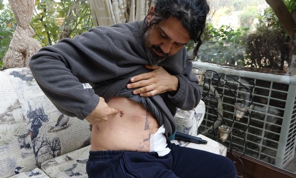 Bıçaklandığı anı kameraya çekti