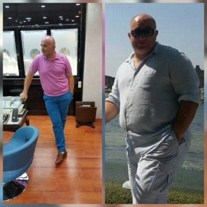 Obezite Hastaları Antalya'da Buluşuyor