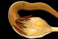 METABOLIK - Genç Kadınlar Dikkat