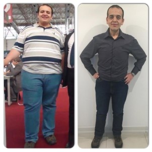 'MR Cihazına Sığamazsınız' Cümlesi Zayıflattı