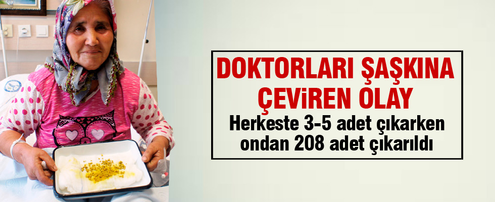 Doktorlar bile şaşırdı