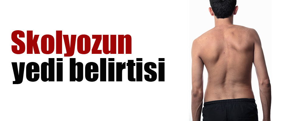 Skolyozun yedi belirtisi