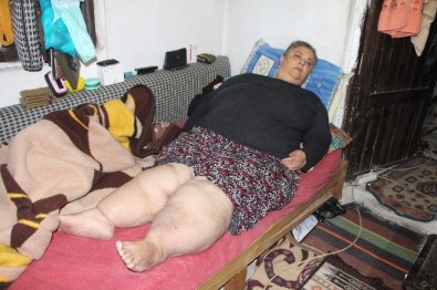 Fethiye'de Fil Hastası Kadının Dramı Yürek Burkuyor