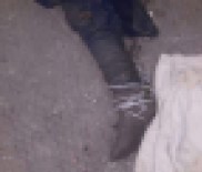 KATI ATIK TESİSİ - Çöpten Çıkan Bacağın Sırrını Kayıp Başvuruları Çözecek